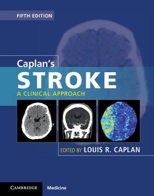 CAPLANS STROKE